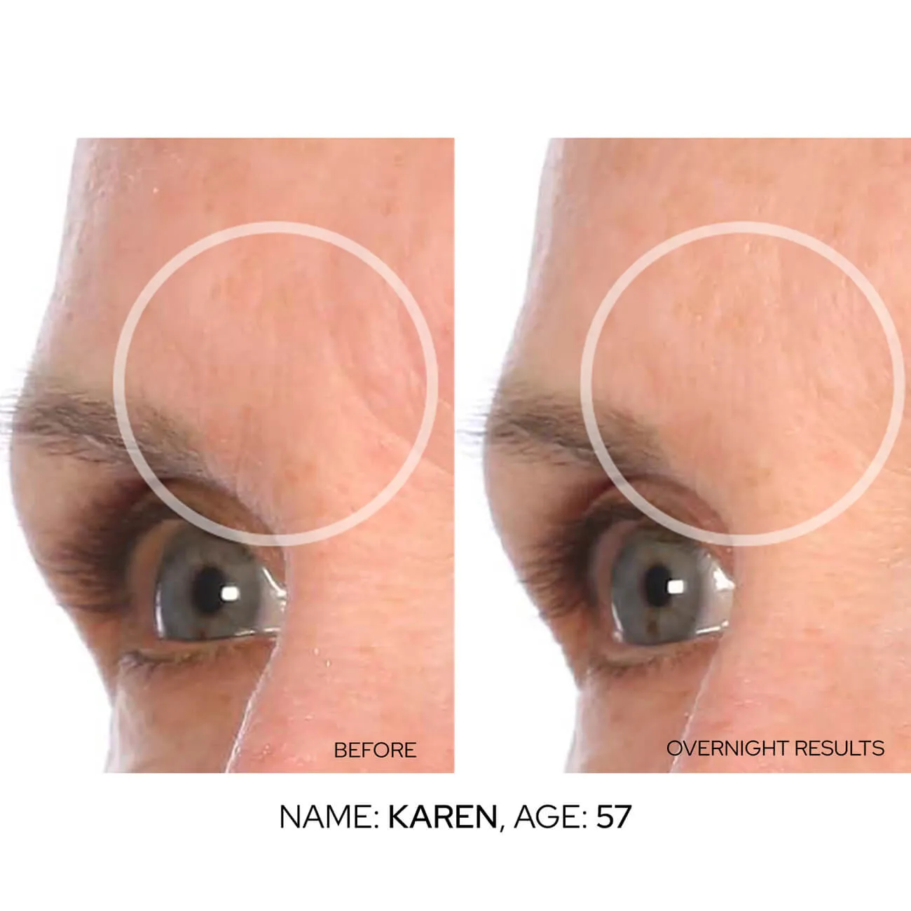 BrowLift Value Packs